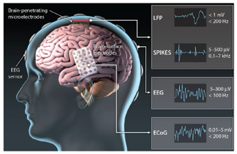 Brain-Computer Interface